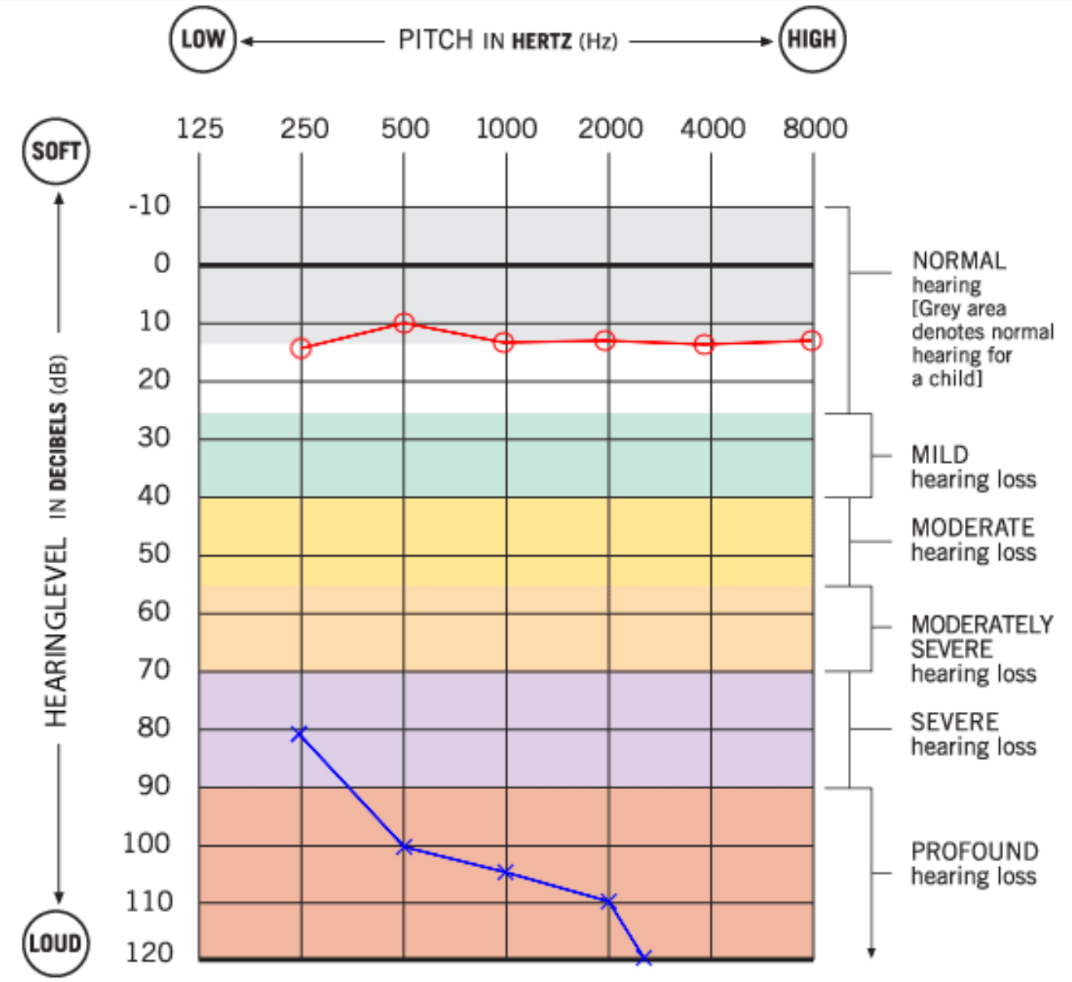 Blank Audiogram Template Download Business fromgrandma best